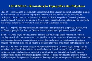 Slide 16 – Esse paciente foi submetido à ressecção de toda a região pré tarsal da pálpebra inferior,
do canto lateral e do 1/3 lateral da pálpebra superior. Na foto central nota-se o enxerto de
cartilagem colocado sobre a conjuntiva tracionada da pálpebra superior e fixado no periósteo
medial e lateral. A camada muscular e a de pele foram substituidas conjuntamente por um retalho
miocutâneo bipediculado, retirado da área préseptal da pálpebra superior.
LEGENDAS - Reconstrução Topográfica das Pálpebras
Slide 17 – Aspecto pós-operatório tardio mostrando a margem estável em posicão normal, com
perfeita recuperação dos fórnices. O canto lateral apresenta-se ligeiramente medializado.
Slide 18 – Outra opção para reconstruir a lamela posterior da pálpebra consiste em retirar a
cartilagem auricular juntamente com o pericôndrio na sua face côncava. Coloca-se o enxerto com a
membrana pericondrial em contato com a superfície ocular pois ela rapidamente mimetiza a
mucosa conjuntival. Esse tipo de enxerto é utilizado em perdas localizadas da traquéia desde 1997.
Slide 19 – As fotos mostram o aspecto pós-operatório imediato da reconstrução topográfica de
mais da metade da pálpebra inferior, acrescida do canto lateral, na qual foi usado um enxerto de
cartilagem com pericôndrio para substituir a lamela posterior. Um retalho músculo-cutâneo
confeccionado na área préseptal da pálpebra superior foi usado para recobrir e nutrir o enxerto.
Verifica-se que a face posterior da pálpebra e da margem é lisa e não agressiva à superfície ocular.
 