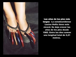 Las uñas de los pies más largas :  La estadounidense Louise Hollis tiene este récord. Se deja crecer las uñas de los pies desde 1982. Entre las diez suman una longitud total de 2,21 metros.  
