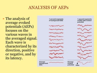 ANALYSIS OF AEPs
 The analysis of
average evoked
potentials (AEPs)
focuses on the
various waves in
the averaged signal.
Each wave is
characterized by its
direction, positive
or negative, and by
its latency.
 