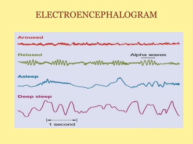 Recording brain activity | PPTX | Brain and Nervous System Disorders ...