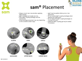 sam® Placement
MK 1124-00 A
 