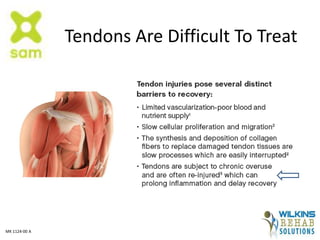 Tendons Are Difficult To Treat
MK 1124-00 A
 