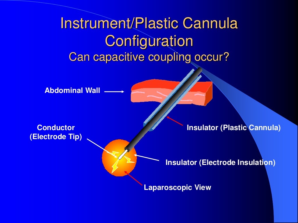 Electro surgery in laparoscopy