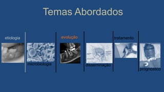 Temas Abordados
vias de
disseminação
tratamento
prognóstico
etiologia
microbiologia
evolução
 