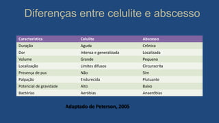 Diferenças entre celulite e abscesso
Característica Celulite Abscesso
Duração Aguda Crônica
Dor Intensa e generalizada Localizada
Volume Grande Pequeno
Localização Limites difusos Circunscrita
Presença de pus Não Sim
Palpação Endurecida Flutuante
Potencial de gravidade Alto Baixo
Bactérias Aeróbias Anaeróbias
Adaptado de Peterson, 2005
 