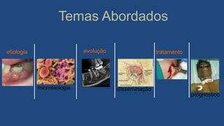 Temas Abordados
etiologia
microbiologia
evolução
vias de
disseminação
tratamento
prognóstico
 