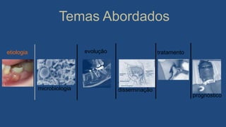 Temas Abordados
microbiologia
evolução
vias de
disseminação
tratamento
prognóstico
etiologia
 