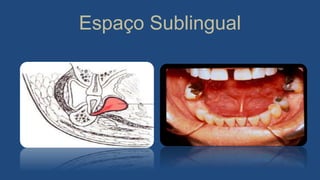 Espaço Sublingual
 