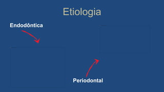 Etiologia
Endodôntica
Periodontal
 