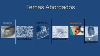 Temas Abordados
prognóstico
diagnósticoetiologia
microbiologia disseminação
tratamento
 