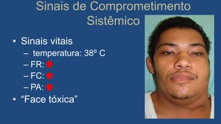 Sinais de Comprometimento
Sistêmico
• Sinais vitais
– temperatura: 38º C
– FR:
– FC:
– PA:
• “Face tóxica”
 