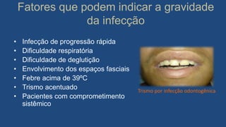 Fatores que podem indicar a gravidade
da infecção
• Infecção de progressão rápida
• Dificuldade respiratória
• Dificuldade de deglutição
• Envolvimento dos espaços fasciais
• Febre acima de 39ºC
• Trismo acentuado
• Pacientes com comprometimento
sistêmico
Trismo por infecção odontogênica
 