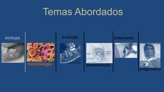 Temas Abordados
evolução
vias de
disseminação
tratamento
prognóstico
etiologia
microbiologia
 