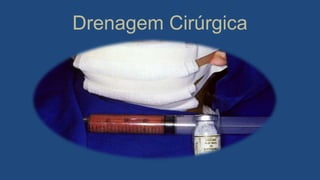 Drenagem Cirúrgica
 