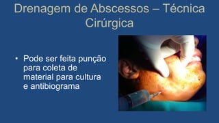 Drenagem de Abscessos – Técnica
Cirúrgica
• Pode ser feita punção
para coleta de
material para cultura
e antibiograma
 