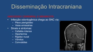Disseminação Intracraniana
ABSCESSO CEREBRAL E MENINGITE
• Infecção odontogênica chega ao SNC via:
– Plexo pterigóideo
– Veias emissárias
• Sinais e sintomas:
– Cefaléia intensa
– Hipertermia
– Rigidez nucal
– Vômitos
– Convulsões
 