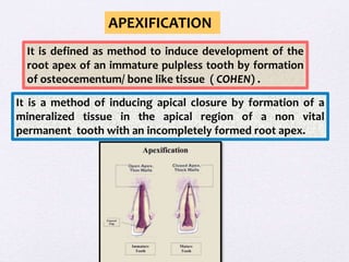 pulp therapy in young permanent tooth | PPTX