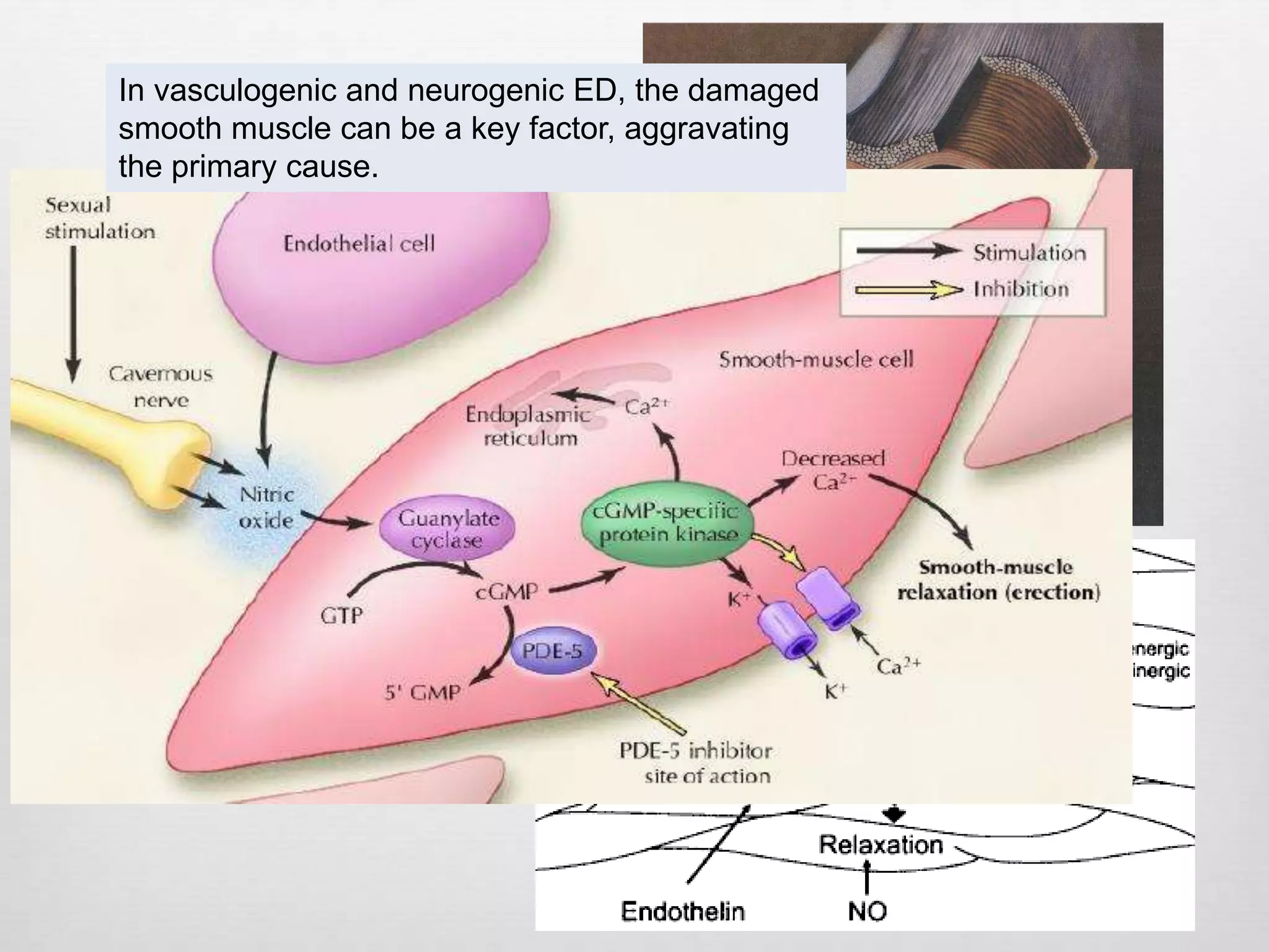 Anatomy and physiology of Erection & pathophysiology of erectile ...
