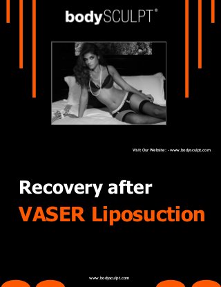 Visit Our Website: - www.bodysculpt.com

Recovery after

VASER Liposuction

www.bodysculpt.com

 