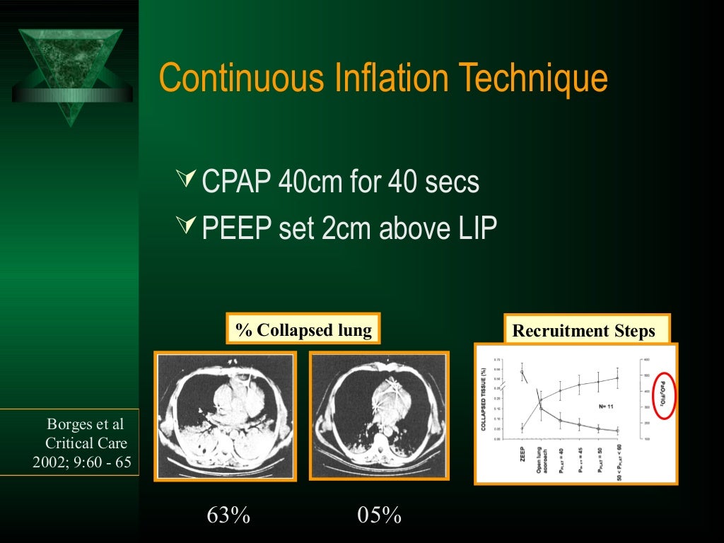 Recruitment Maneuvers in ARDS Dr Chennamchetty