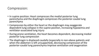 Compression:
• In supine position: Heart compresses the medial posterior lung
parenchyma and the diaphragm compresses the posterior-caudal lung
parenchyma
• Compression by either the heart or the diaphragm may exaggerate
dependent lung collapse in the supine position, increasing hypoxemia and
ventilator-associated lung injury
• During prone ventilation, the heart becomes dependent, decreasing medial
posterior lung compression
• The diaphragm is displaced caudally (especially in non-obese patients and
when the abdomen is left unsupported), decreasing compression of the
posterior-caudal lung parenchyma Improve ventilation and oxygenation
 