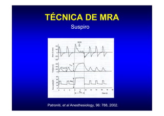 TÉCNICA DE MRA
               Suspiro




Patroniti, et al Anesthesiology, 96: 788, 2002.
 