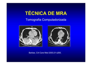TÉCNICA DE MRA
Tomografia Computadorizada




  Barbas, Crit Care Med 2003;31:s265.
 