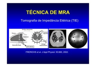 TÉCNICA DE MRA
Tomografia de Impedância Elétrica (TIE)




   FRERICHS et al. J Appl Physiol. 93:660, 2002.
 