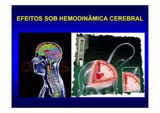 EFEITOS SOB HEMODINÂMICA CEREBRAL
 