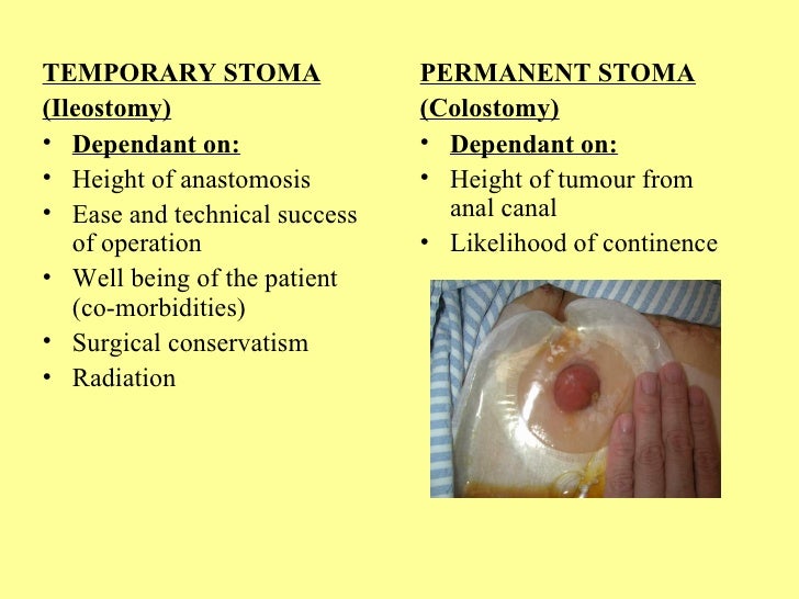 What are some differences between a colostomy and an ileostomy?
