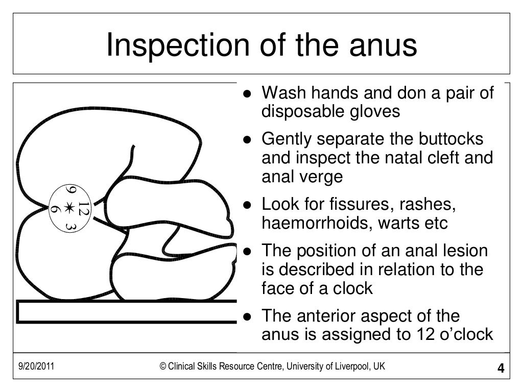 Rectal Examination