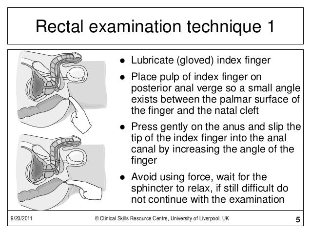 Rectal Exam Sex 104