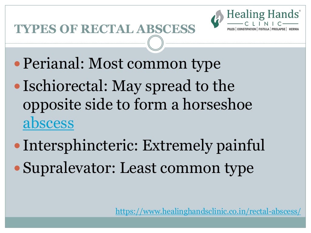 Rectal Abscess | Types, Causes, Symptoms & Treatment