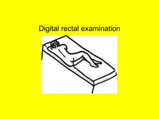 Digital rectal examination
 