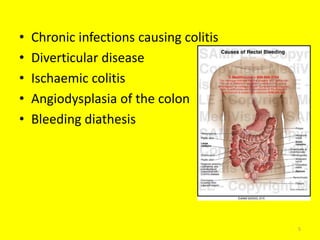 • Chronic infections causing colitis
• Diverticular disease
• Ischaemic colitis
• Angiodysplasia of the colon
• Bleeding diathesis
5
 