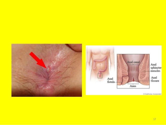 anus