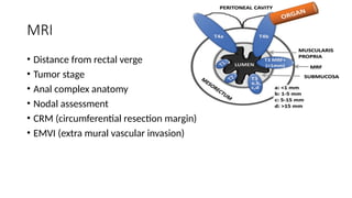Management of colorectal carcinoma .pptx
