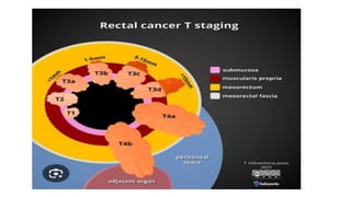 rectal cancer 2024 management guidelines