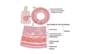 rectal cancer 2024 management guidelines