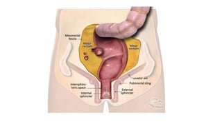 rectal cancer 2024 management guidelines