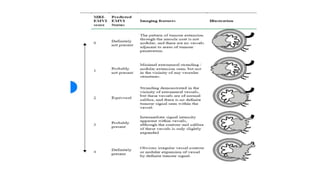 rectal cancer 2024 management guidelines