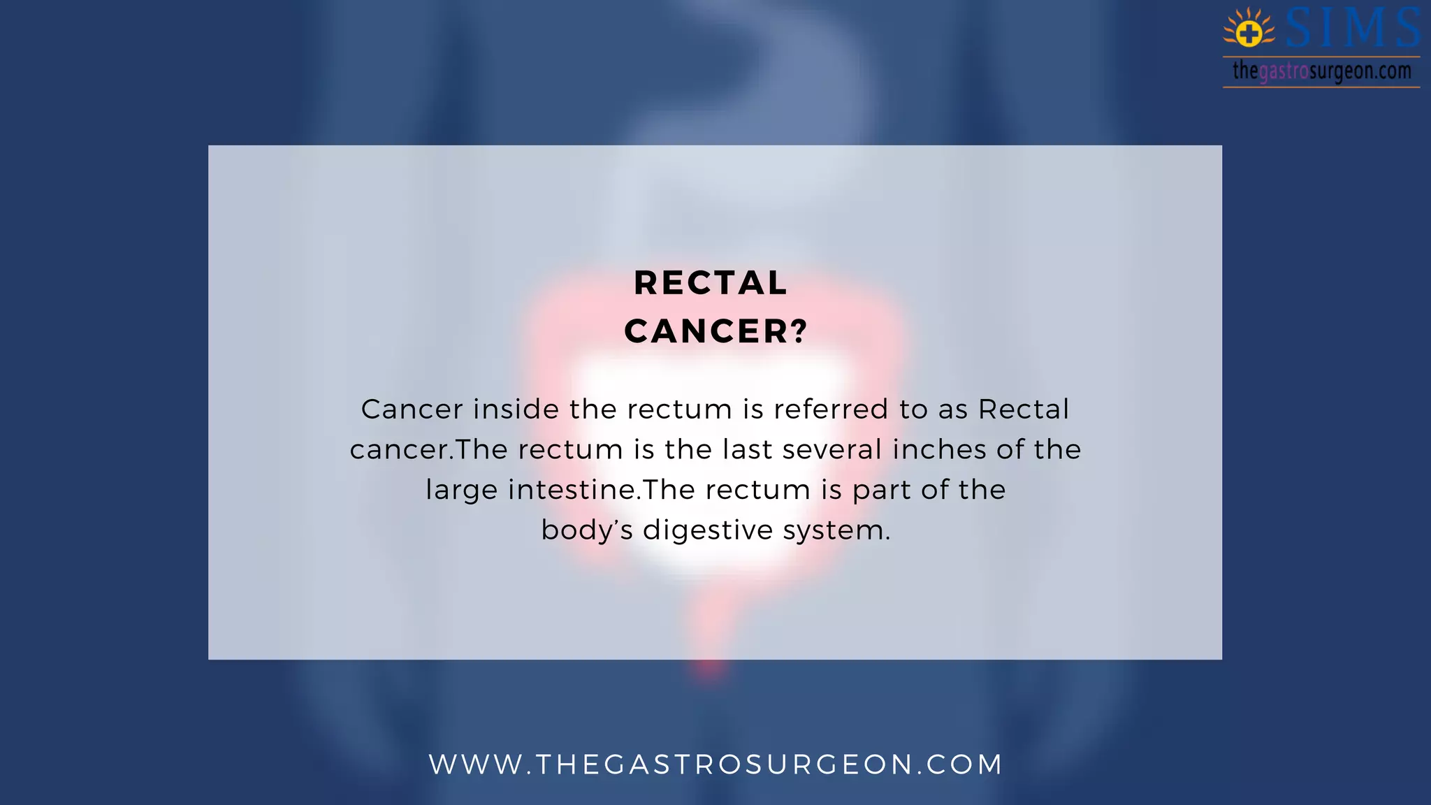 Rectal cancer | PDF