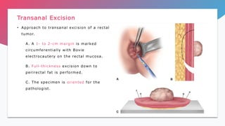 rectal-carcinoma-pptx