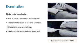 Rectal Carcinoma | PPTX