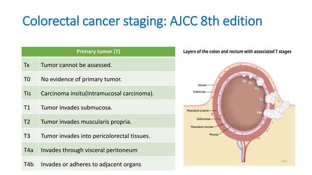 Rectal Carcinoma | PPTX