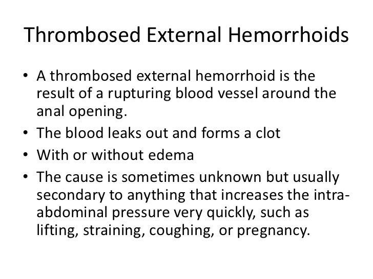 Rectal Pain Diagnosis and Treatment