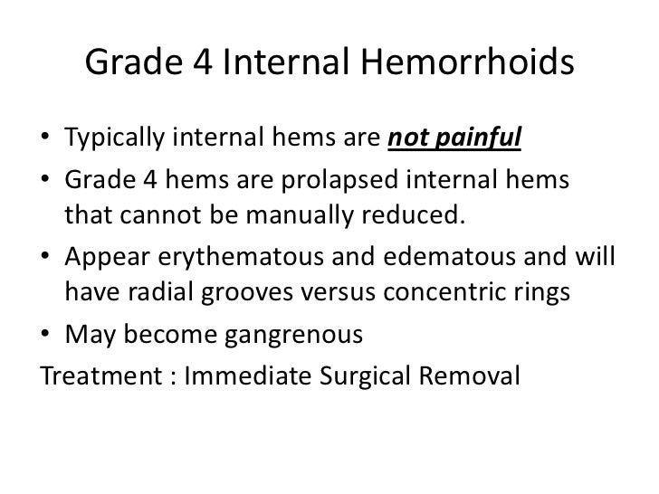 Rectal Pain Diagnosis and Treatment