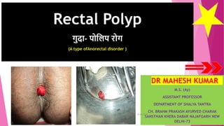 Rectal Polyp
गुदा- पोलिप रोग
(A type ofAnorectal disorder )
DR MAHESH KUMAR
M.S. (Ay)
ASSISTANT PROFESSOR
DEPARTMENT OF SHALYA TANTRA
CH. BRAHM PRAKASH AYURVED CHARAK
SANSTHAN KHERA DABAR NAJAFGARH NEW
DELHI-73
25-08-2020
Rectal Polyp-Dr Mahesh Kumar
1
 