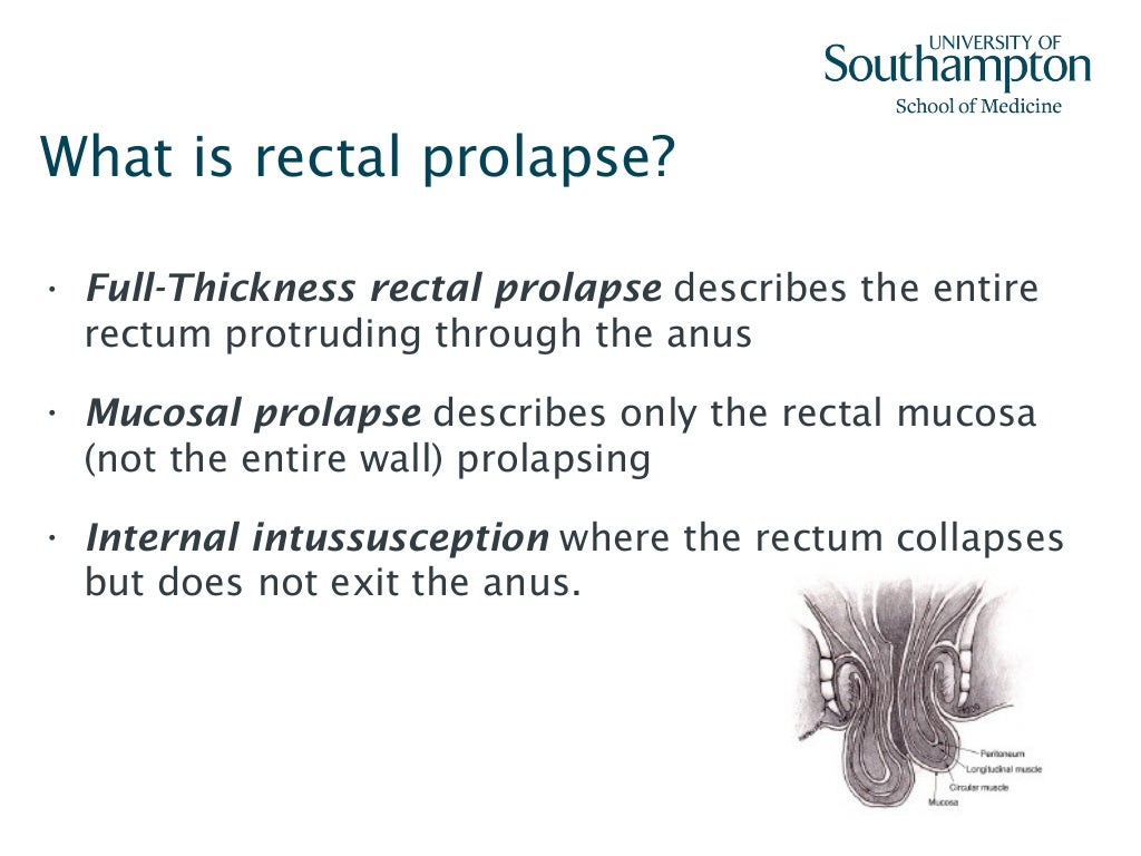 Rectal prolapse