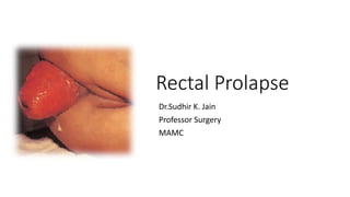 Rectal Prolapse
Dr.Sudhir K. Jain
Professor Surgery
MAMC
 